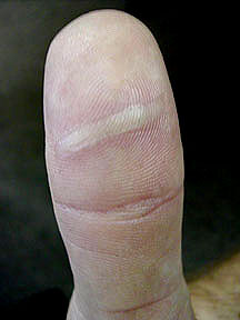 thumb.jpg